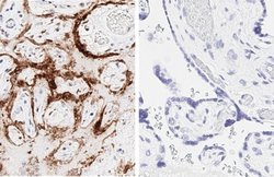 Invitrogen SARS-CoV-2 Nucleocapsid Recombinant Rabbit Monoclonal Antibody