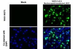 Invitrogen SARS-CoV-2 Nucleocapsid Recombinant Rabbit Monoclonal Antibody