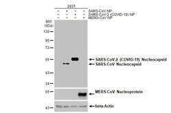 Invitrogen SARS-CoV-2 Nucleocapsid Recombinant Rabbit Monoclonal Antibody