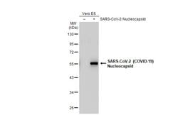 Invitrogen SARS-CoV-2 Nucleocapsid Recombinant Rabbit Monoclonal Antibody
