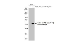 Invitrogen SARS-CoV-2 Nucleocapsid Recombinant Rabbit Monoclonal Antibody