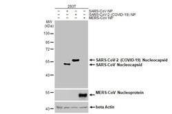Invitrogen SARS-CoV-2 Nucleocapsid Recombinant Rabbit Monoclonal Antibody