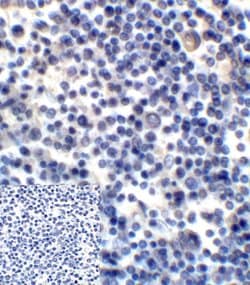Invitrogen CD276 (B7-H3) Monoclonal Antibody (2H5) 100 &mu;g; Unconjugated:Antibodies,