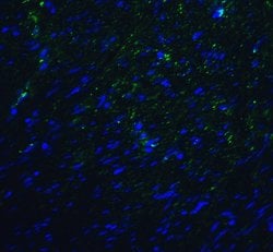 Invitrogen TMIGD2 Monoclonal Antibody (8A1) 100 &mu;g; Unconjugated:Antibodies,