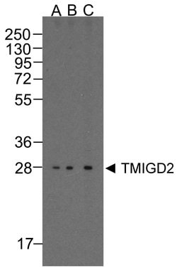 Invitrogen TMIGD2 Monoclonal Antibody (8A1) 100 &mu;g; Unconjugated:Antibodies,