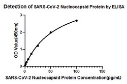 SARS-CoV-2 Nucleocapsid Recombinant Rabbit Monoclonal Antibody (4Z6T2),