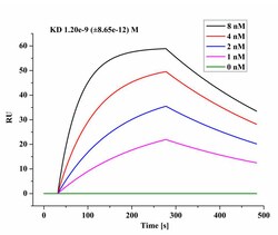 SARS-CoV-2 Nucleocapsid Recombinant Rabbit Monoclonal Antibody (4Z6T2),