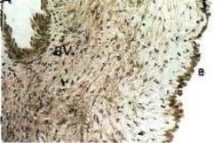 Invitrogen PTHLH Monoclonal Antibody (3979) 100 &mu;L; Unconjugated:Antibodies,