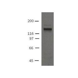 Invitrogen Desmoglein 2 Monoclonal Antibody (10D2) 100 &mu;L; Unconjugated:Antibodies,