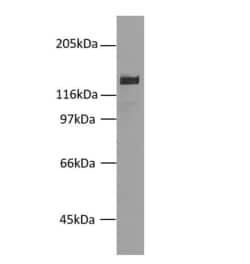 Invitrogen Desmoglein 2 Monoclonal Antibody (7H9) 100 &mu;L; Unconjugated:Antibodies,