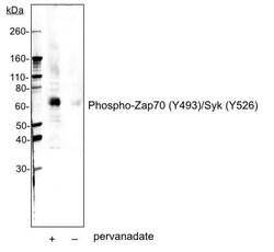 Phospho-ZAP70/Syk (Tyr493, Tyr526) Recombinant Rabbit Monoclonal Antibody
