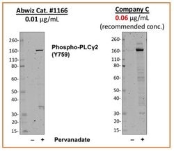 Invitrogen Phospho-PLCg2 (Tyr759) Recombinant Rabbit Monoclonal Antibody