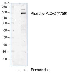 Invitrogen Phospho-PLCg2 (Tyr759) Recombinant Rabbit Monoclonal Antibody