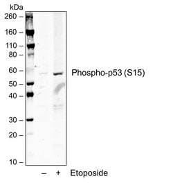 Phospho-p53 (Ser15) Recombinant Rabbit Monoclonal Antibody (P53S15-1C11),