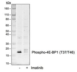 Invitrogen Phospho-4EBP1 (Thr37, Thr46) Recombinant Rabbit Monoclonal Antibody