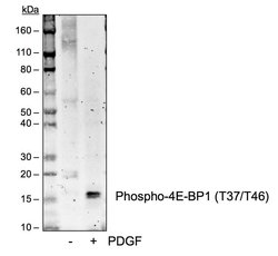 Invitrogen Phospho-4EBP1 (Thr37, Thr46) Recombinant Rabbit Monoclonal Antibody