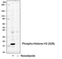Invitrogen Phospho-Histone H3 (Ser28) Recombinant Rabbit Monoclonal Antibody