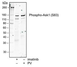 Invitrogen Phospho-Ask1 (Ser83) Recombinant Rabbit Monoclonal Antibody