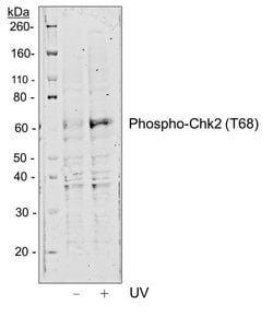 Invitrogen Phospho-Chk2 (Thr68) Recombinant Rabbit Monoclonal Antibody