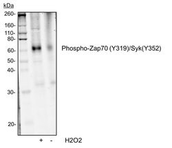 Invitrogen Phospho-ZAP70/Syk (Tyr319, Tyr352) Recombinant Rabbit Monoclonal