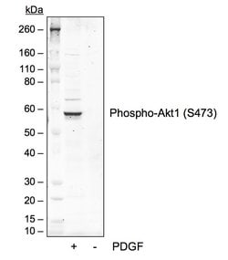 Phospho-Akt1 (Ser473) Recombinant Rabbit Monoclonal Antibody (AktS473-B9),