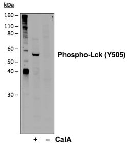 Invitrogen Phospho-Lck (Tyr505) Recombinant Rabbit Monoclonal Antibody