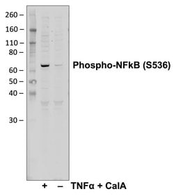 Invitrogen Phospho-NFkB p65 (Ser536) Recombinant Rabbit Monoclonal Antibody