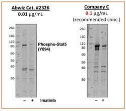 Phospho-Stat5 (Tyr694) Recombinant Rabbit Monoclonal Antibody (Stat5Y694-G11),