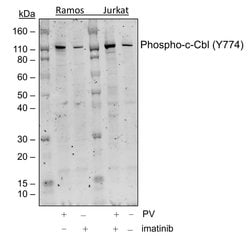 Invitrogen Phospho-c-Cbl (Tyr774) Recombinant Rabbit Monoclonal Antibody