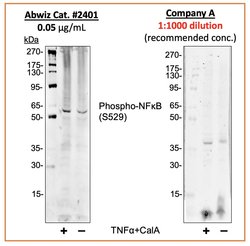 Invitrogen Phospho-NFkB p65 (Ser529) Recombinant Rabbit Monoclonal Antibody