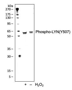 Phospho-Lyn (Tyr507) Recombinant Rabbit Monoclonal Antibody (LynY507-5B6),