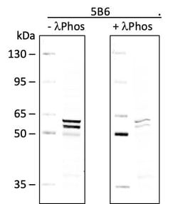 Phospho-Lyn (Tyr507) Recombinant Rabbit Monoclonal Antibody (LynY507-5B6),