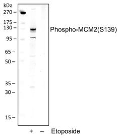 Phospho-MCM2 (Ser139) Recombinant Rabbit Monoclonal Antibody (MCM2S139-B12),