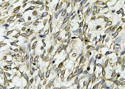 Invitrogen Claudin 6 Monoclonal Antibody (AFB17981) 100 &mu;L; Unconjugated:Antibodies,