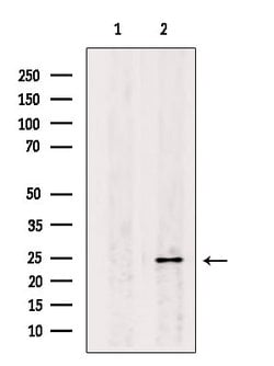 Invitrogen Claudin 6 Monoclonal Antibody (AFB17981) 100 &mu;L; Unconjugated:Antibodies,