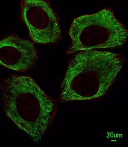 Invitrogen beta Tubulin Monoclonal Antibody (87CT59.3.7) 400 &mu;L; Unconjugated:Antibodies,