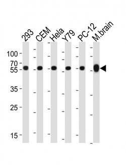 Invitrogen beta Tubulin Monoclonal Antibody (87CT59.3.7) 400 &mu;L; Unconjugated:Antibodies,