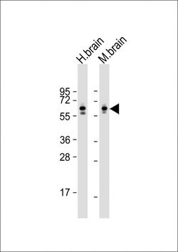 Invitrogen CRMP2 Monoclonal Antibody (33CT11.7.6) 400 &mu;L; Unconjugated:Antibodies,