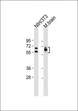 Invitrogen CRMP2 Monoclonal Antibody (33CT11.7.6) 400 &mu;L; Unconjugated:Antibodies,