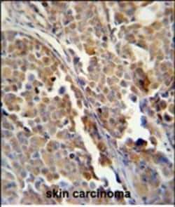 Invitrogen ALDH3A2 Monoclonal Antibody (151CT1.3.1) 100 &mu;L; Unconjugated:Antibodies,