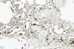Invitrogen LAMP2 Monoclonal Antibody (157CT16.6.6) 400 &mu;L; Unconjugated:Antibodies,