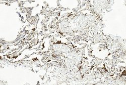 Invitrogen LAMP2 Monoclonal Antibody (157CT16.6.6) 400 &mu;L; Unconjugated:Antibodies,
