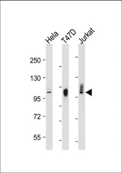 Invitrogen LAMP2 Monoclonal Antibody (157CT16.6.6) 400 &mu;L; Unconjugated:Antibodies,