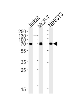RPS6KB2 Monoclonal Antibody (164CT21.2.2), Invitrogen 400 &mu;L; Unconjugated:Antibodies,