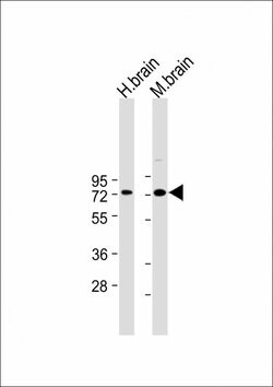 Invitrogen LIMK1 Monoclonal Antibody (175CT3.2.5) 400 &mu;L; Unconjugated:Antibodies,