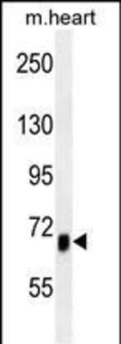 ACVR1B Monoclonal Antibody (179CT11.2.1):Antibodies, Monoclonal