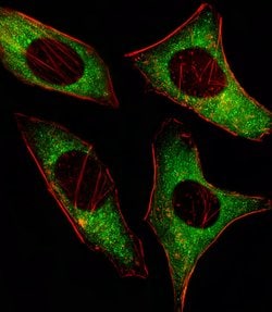 AMPK alpha-2 Monoclonal Antibody (206CT5.4.2):Antibodies, Monoclonal