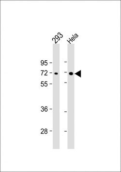 AMPK alpha-2 Monoclonal Antibody (206CT5.4.2):Antibodies, Monoclonal