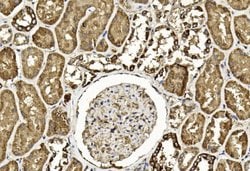 Invitrogen TGF beta-2 Monoclonal Antibody (220ct16.4.3.1) 400 &mu;L; Unconjugated:Antibodies,