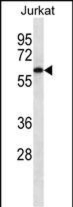 Invitrogen&trade;&nbsp;CAMKK2 Monoclonal Antibody (239CT7.5.3)